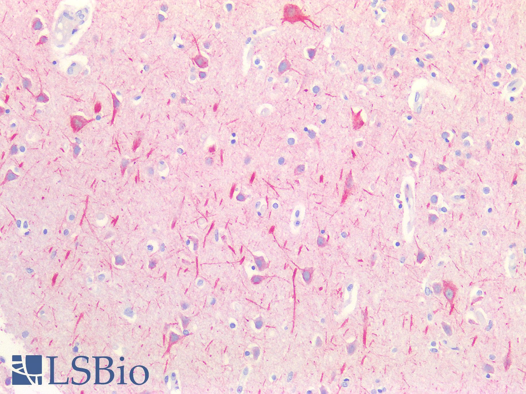 PathPlus™ Polyclonal Rabbit anti-Human NF-L / NEFL Antibody (IHC, IF, WB)