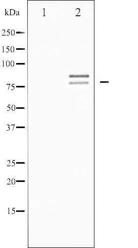 Polyclonal Rabbit anti-Human LIPE / HSL Antibody (phospho-Ser855,phospho-Ser554, IHC, IF, WB)