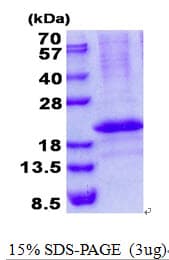 Human RCAN3 / Calcipressin 3 Protein (Recombinant His)