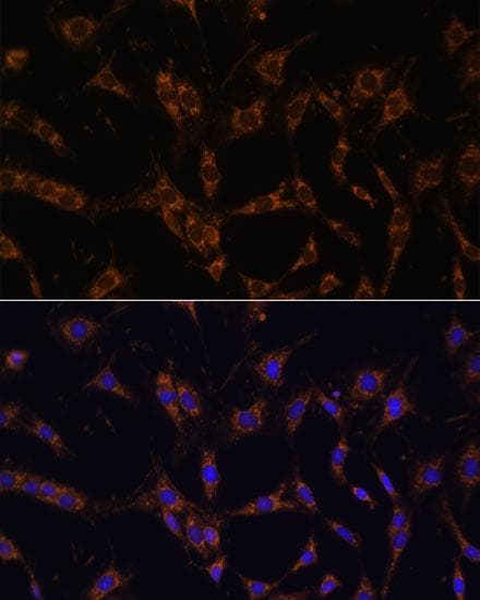 Ubc6p Homolog (HSU93243) (UBE2J1) Antibody