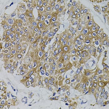 ARHGEF11 Antibody