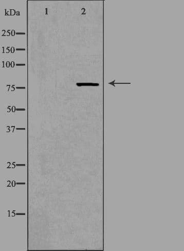 NCBP1 / CBP80 Antibody