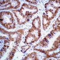 Monoclonal Mouse anti-Human TP53 / p53 Antibody (IHC, IF, WB)