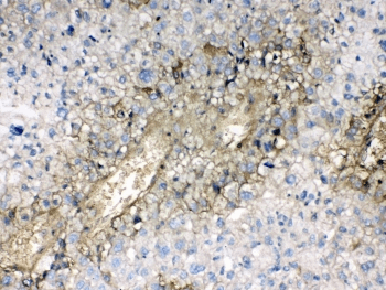 Polyclonal Rabbit anti-Human HBA1+2 / Hemoglobin Alpha Antibody (IHC, WB)