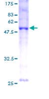 Human BNIP1 Protein (Recombinant GST)