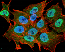 ATXN1 / SCA1 Antibody (clone S76-8)