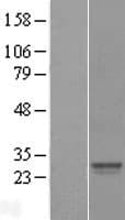 SRY Protein (Over-Expression Lysate Myc-DDK (Flag))