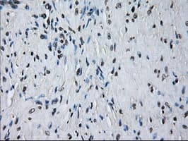 Monoclonal Mouse anti-Human PRDX4 / Peroxiredoxin 4 Antibody (clone OTI9A3, IHC, IF, WB)