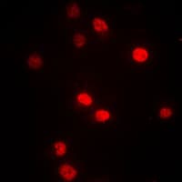 DNMT3B Antibody (N-Terminus)