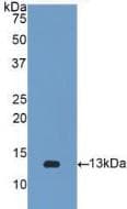 B2M / Beta 2 Microglobulin Antibody (aa22-119, FITC)