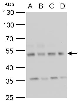 IHC-plus™ CAMK2D / CaMKII Delta Antibody (aa249-445)