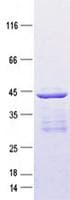 Human KRT19 / CK19 / Cytokeratin 19 Protein (Recombinant GST, N-terminus)