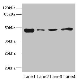 Polyclonal Rabbit anti-Human PDK3 Antibody (IHC, WB)