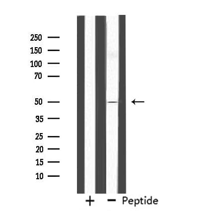 FOXN4 Antibody