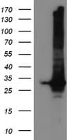 GSTT2 Antibody (clone OTI3B6)