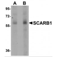 SCARB1 / SR-BI Antibody