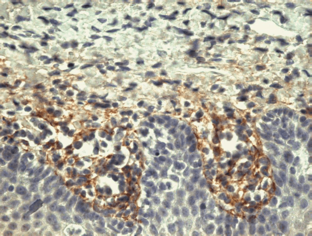 Monoclonal Mouse anti-Human TNC / Tenascin C Antibody (clone T2H5, IHC, WB)