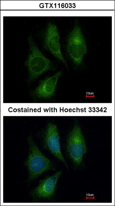 EDN1 / Endothelin 1 Antibody (aa141-212)