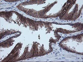 MMACHC Antibody (clone OTI1A4)