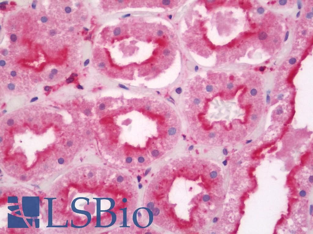 IHC-plus™ TNKS1BP1 / TAB182 Antibody (aa1601-1650)