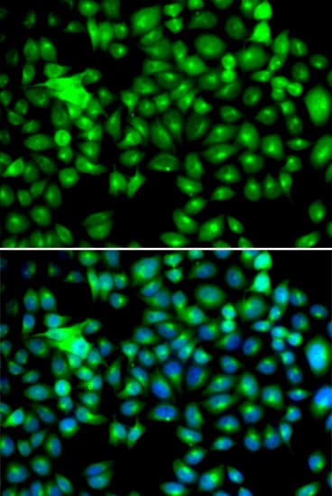 Polyclonal Rabbit anti-Human HSPB8 / H11 / HSP22 Antibody (IHC, IF, WB)