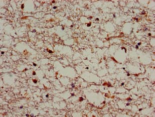 SORL1 Antibody