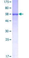 Human SFTPB / Surfactant Protein B (Recombinant GST)