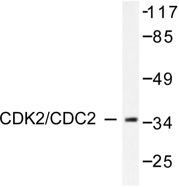 CDK2 Antibody (Val154)