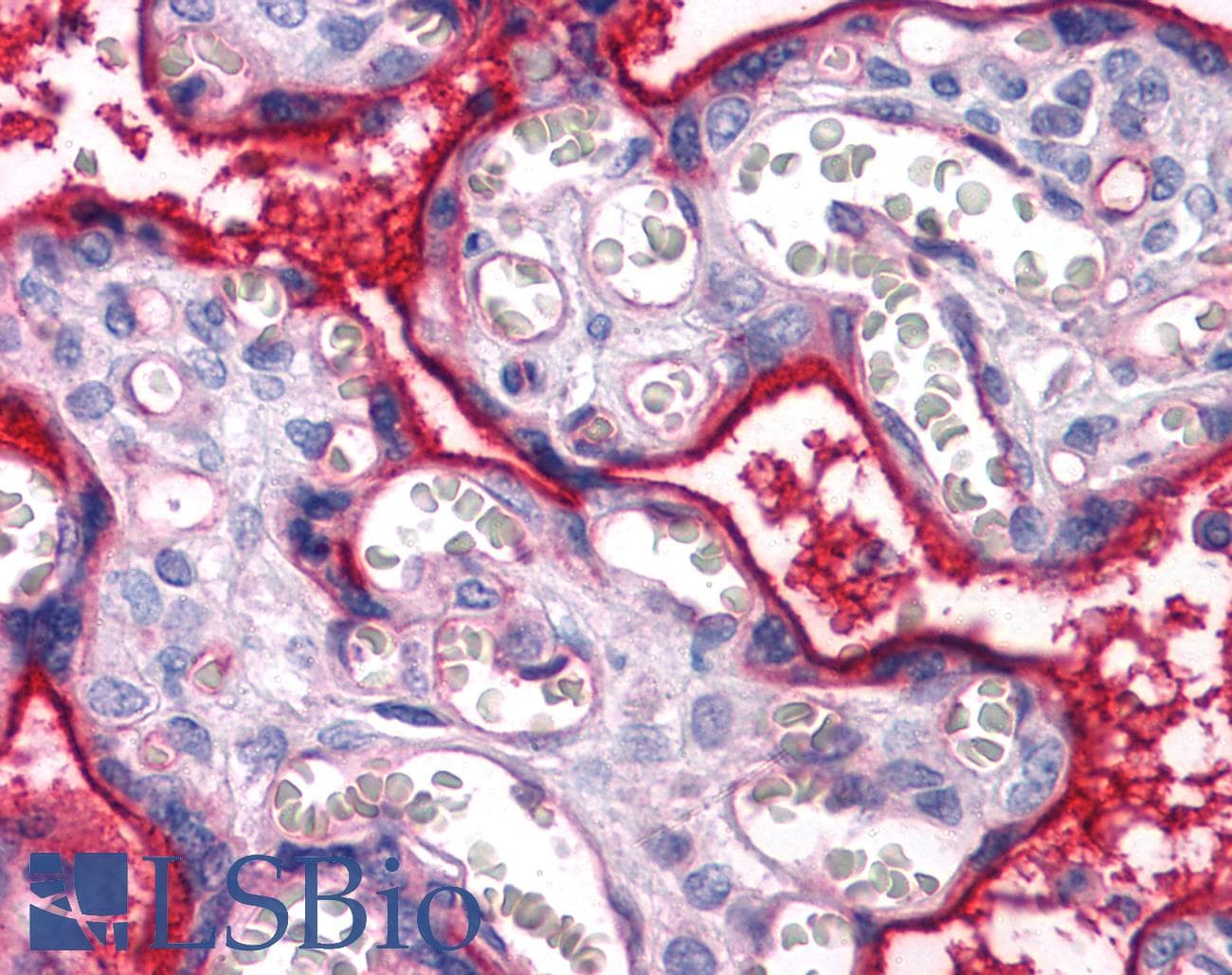 IHC-plus™ Monoclonal Mouse anti-Human ITGA5/Integrin Alpha 5/CD49e Antibody (clone 10F6, IHC, WB)