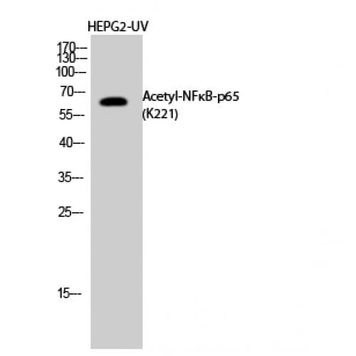 RELA / NFKB p65 Antibody (Internal)