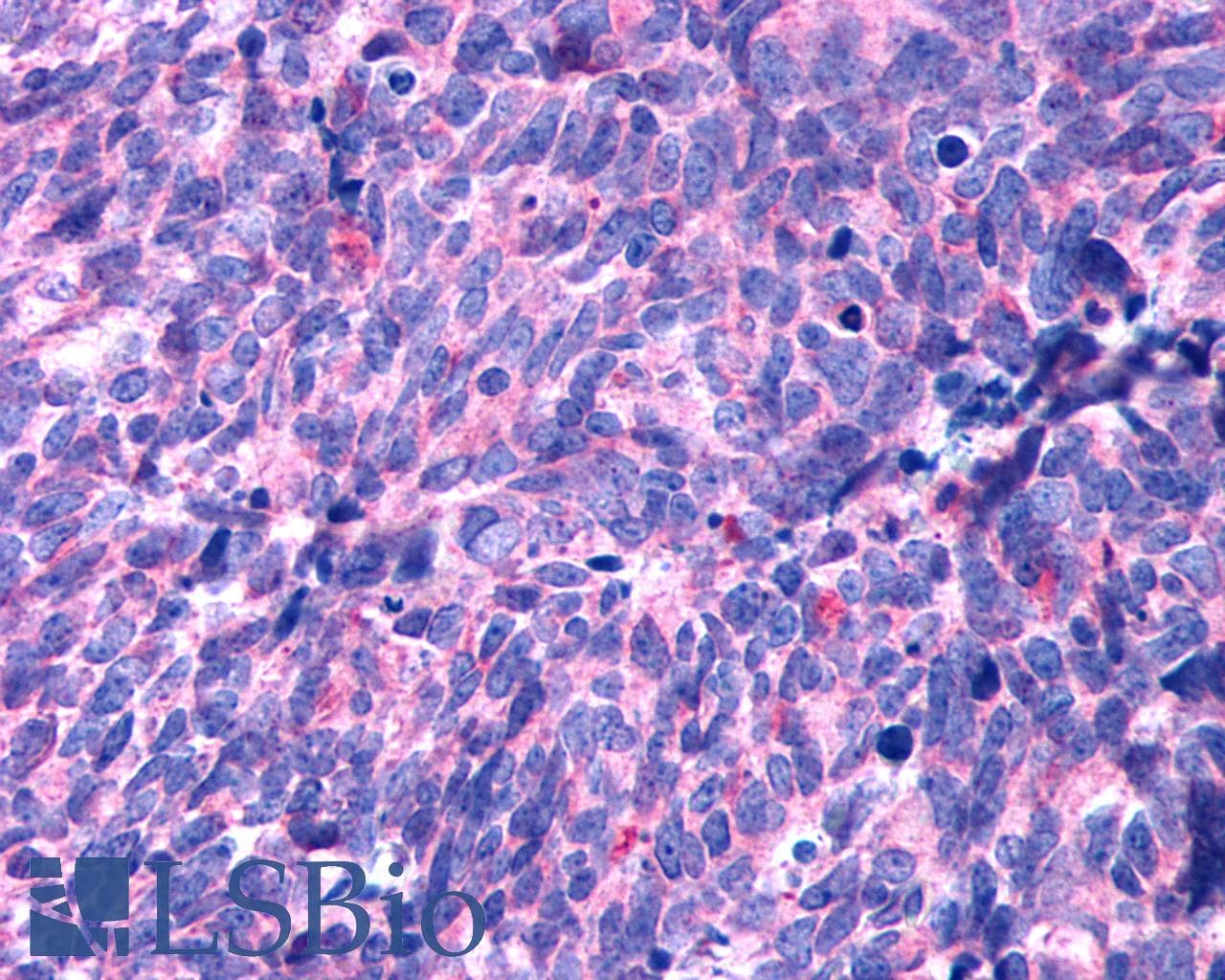 PathPlus™ HTR2B / 5-HT2B Receptor Antibody (N-Terminus)