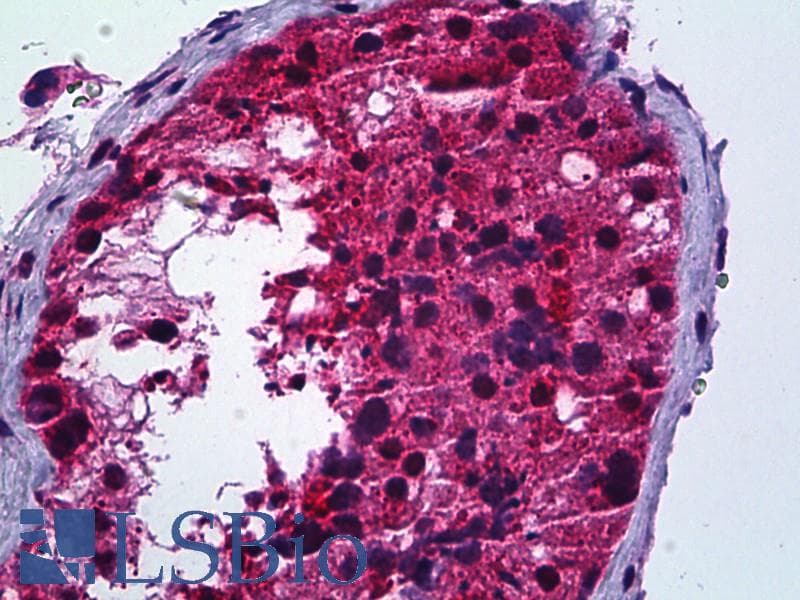 IHC-plus™ PMS2 Antibody (aa125-174)