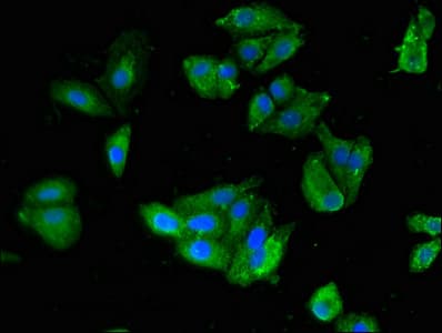 SKIL / SNO / SnoN Antibody