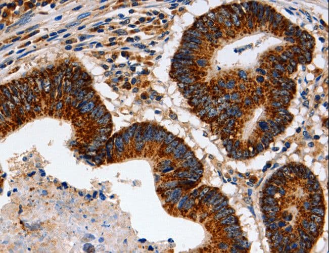 TRAP1 / HSP75 Antibody