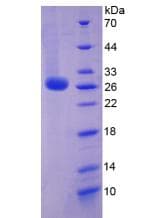 Mouse IL6 / Interleukin 6 Protein (Recombinant His)