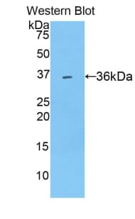 SULT1A1 / Sulfotransferase 1A1 Antibody (aa2-295)