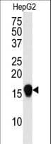 SUMO4 Antibody
