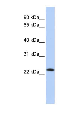 SDF2 Antibody (C-Terminus)