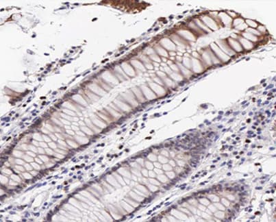 VASP Antibody (phospho-Ser239)