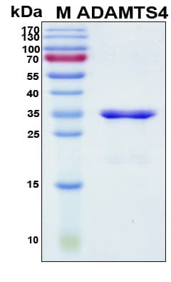 Human ADAMTS4 Protein (Recombinant His, N-Terminal)