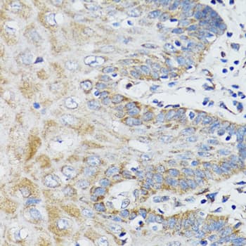 Polyclonal Rabbit anti-Human BAP29 / BCAP29 Antibody (IHC, WB)
