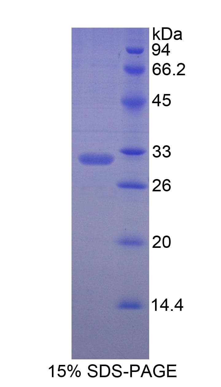 Human MYH7 Protein (Recombinant His)