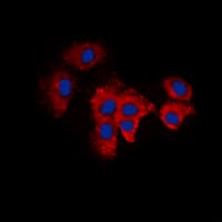 Polyclonal Rabbit anti-Human KDELR2 Antibody (Internal, IHC, IF, WB)