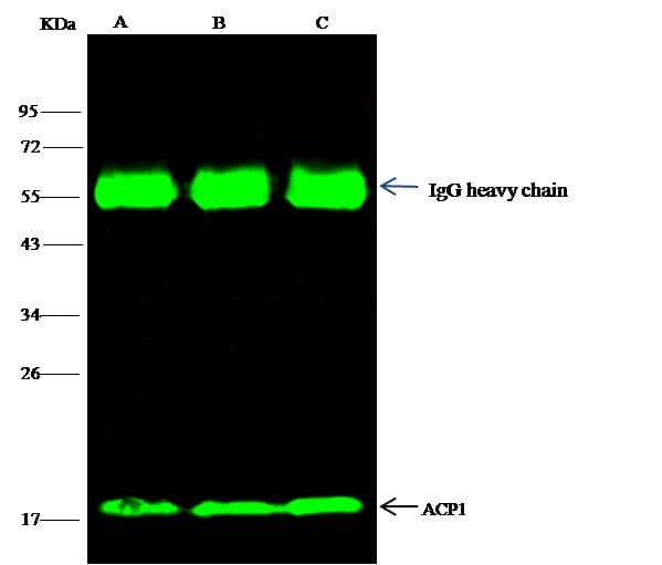 ACP1 / Acid Phosphatase Antibody (Preservative Free)