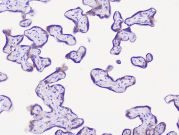 Polyclonal Rabbit anti-Human ENO2 / NSE Antibody (IHC, WB)