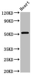 RGS6 Antibody