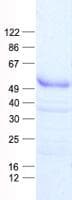 Human GBX2 Protein (Recombinant His, N-Terminal)