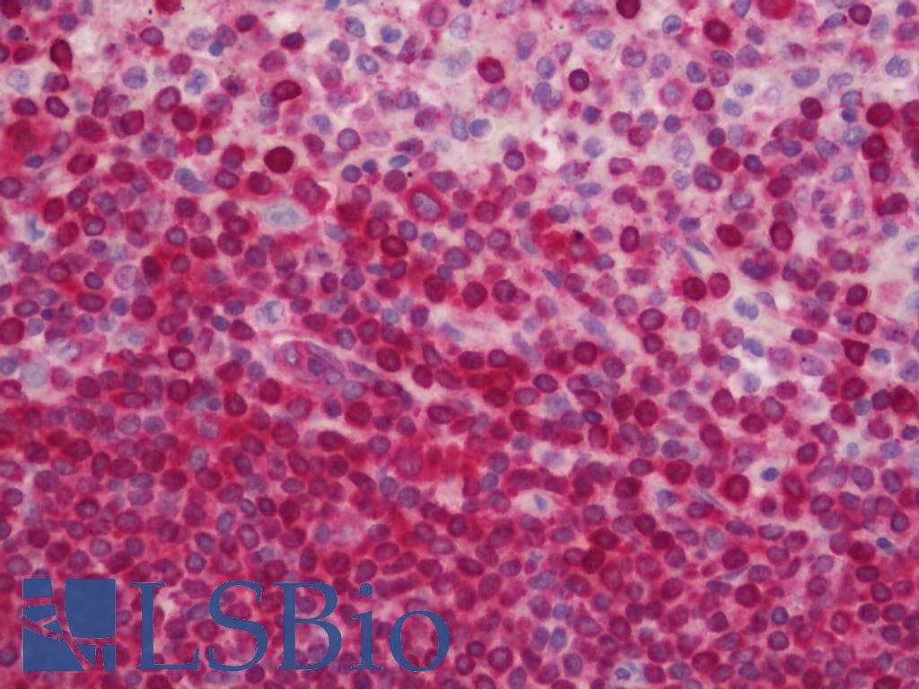 IHC-plus™ HLA-DPB1 Antibody (clone 6C6)