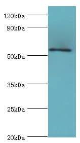 Polyclonal Rabbit anti-Human KLF4 Antibody (aa30-230, IHC, WB)