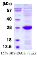 Human ULBP2 / RAET1H Protein (Recombinant His)